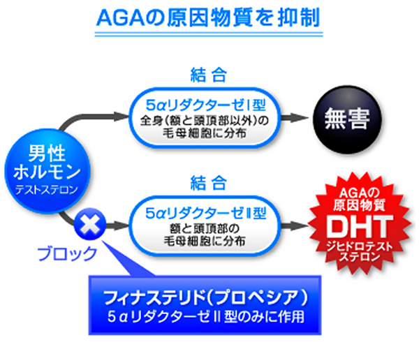 AGAの原因物質を抑制するメカニズム