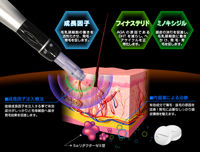 エーツークリニックの成長因子発毛療法　メカニズム
