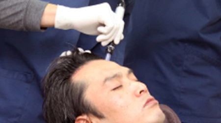 AGA　注入治療　イメージ